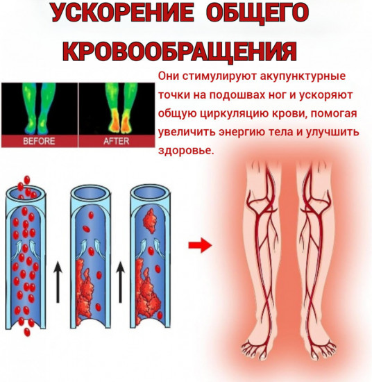 Носки турмалиновые