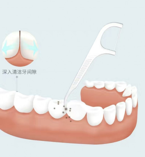 Набор флоссеров