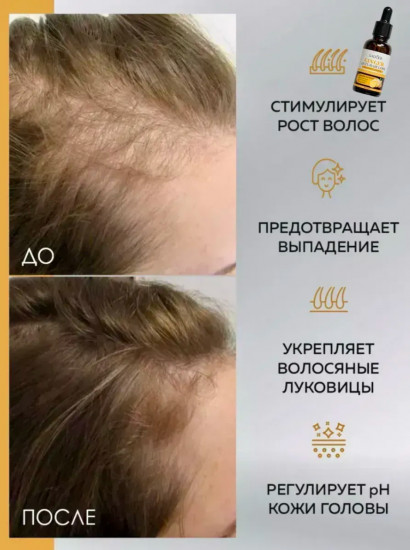 Сыворотка для волос против выпадения