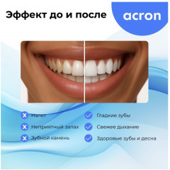 Электрическая зубная щетка Acron E802 - Фото 4