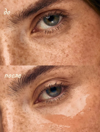 Гидрогелевые патчи для глаз от отеков и темных кругов с коллагеном