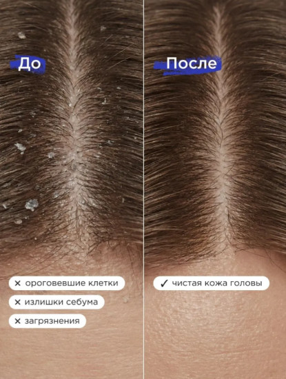 Пилинг для кожи головы