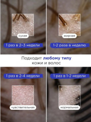 Пилинг для кожи головы - Фото 3
