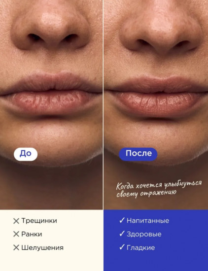 Маска для губ ночная