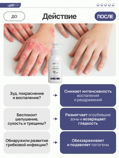 Крем от псориаза и экземы