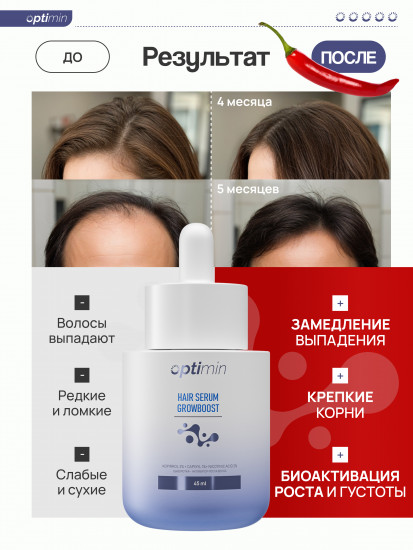 Сыворотка-активатор роста волос «Hair Serum GrowBoost»