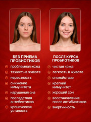 Пробиотик «Хомо-Лакт» - Фото 2