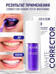 Корректор-сыворотка для отбеливания зубной эмали «Corrector serum teeth whitening» - Фото 11