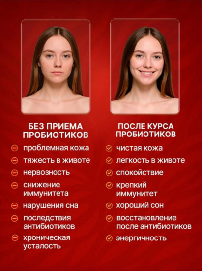 Пробиотик «Хомоспорин-Лакто»