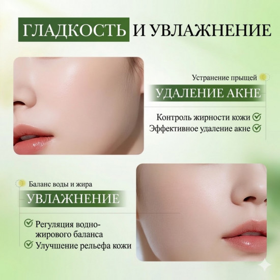 Противовоспалительная сыворотка для проблемной кожи с экстрактом зеленого чая и салициловой кислотой от прыщей и акне