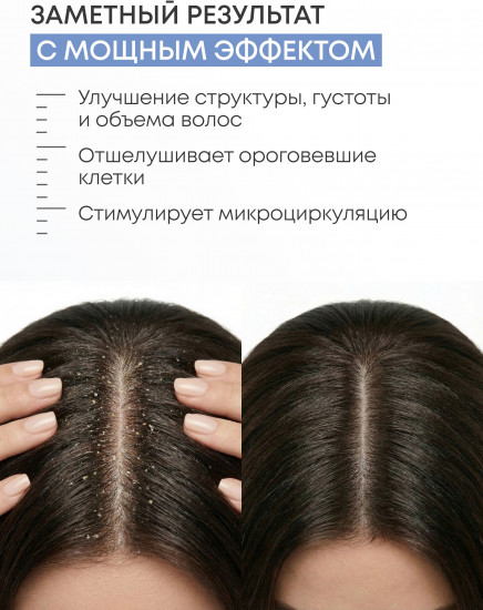 Шампунь против перхоти глубокоочищающий «Anti Dandruff»