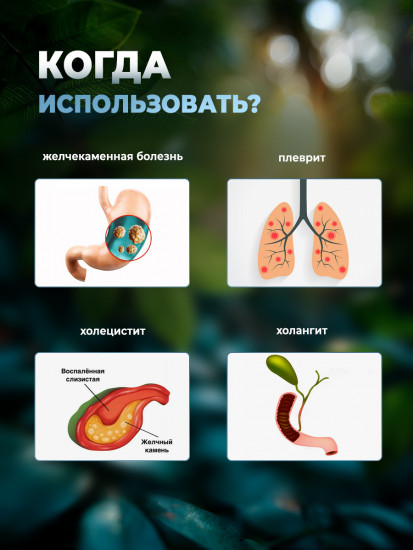 Желчегонный комплекс для желчного пузыря и печени «Лидань»