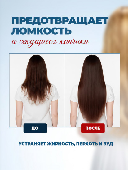 Лосьон-активатор роста волос против выпадения «101»