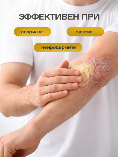 Крем-мазь при псориазе, экземе со зверобоем и дегтем