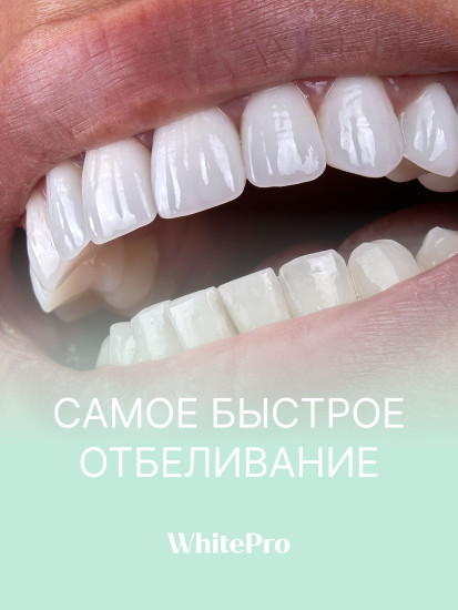 Зубная паста отбеливающая с усиленной формулой для экспресс-результата «Professional white Fast result»