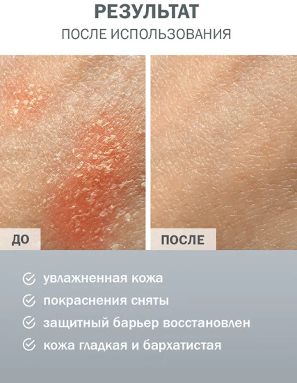 Молочко увлажняющее для тела с пантенолом