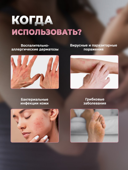 Мазь травяная «Король кожи» от грибка кожи и ногтей, псориаза