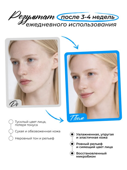 Тонер для лица увлажняющий «Hyaluronic Acid Moisturizing Toner»