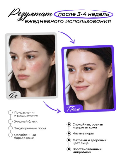 Тонер для лица успокаивающий «Heartleaf Calming Toner»