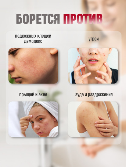 Мыло от демодекоза, прыщей, акне «Manting»