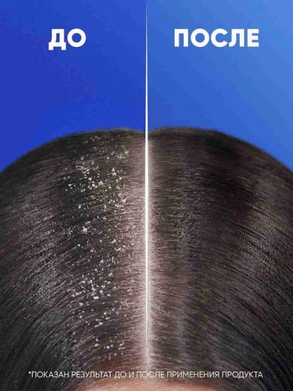 Шампунь против перхоти с экстракотом розмарина «Густые и крепкие. Anti-Dandruff Shampoo Thick & Strong»