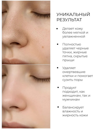 Глиняная маска в стике от черных точек и расширенных пор