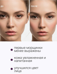 Гель-сыворотка для лица гиалуроновая №72 «Детокс и увлажнение» - Фото 4