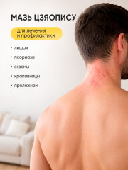 Мазь от лишая, псориаза, экземы и зуда Цзяопису - Фото 5