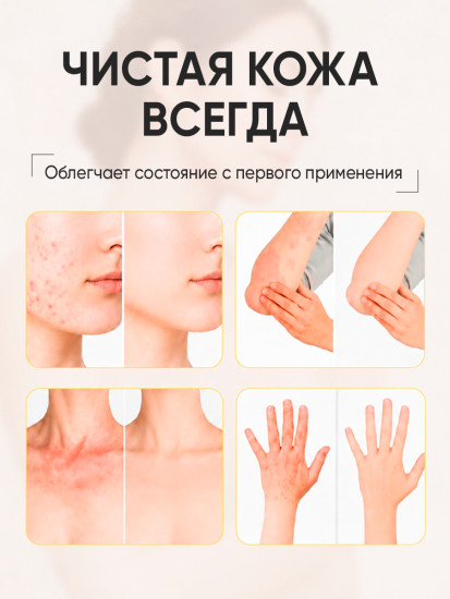 Мазь от лишая, псориаза, экземы и зуда Цзяопису