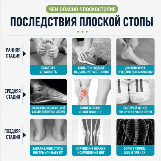 Ортопедические стельки для детей