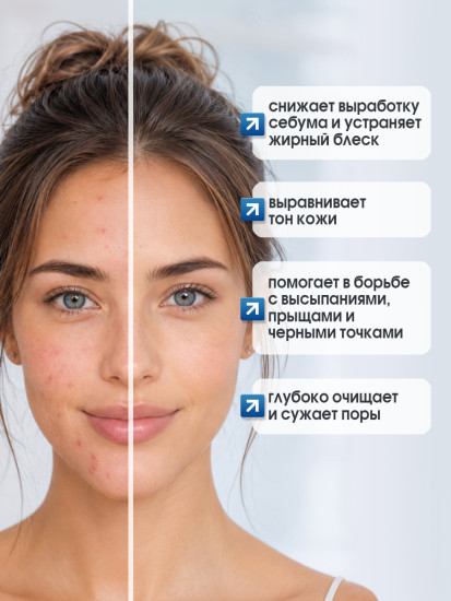 Мыло с морской солью и козьим молоком: от прыщей, акне и черных точек