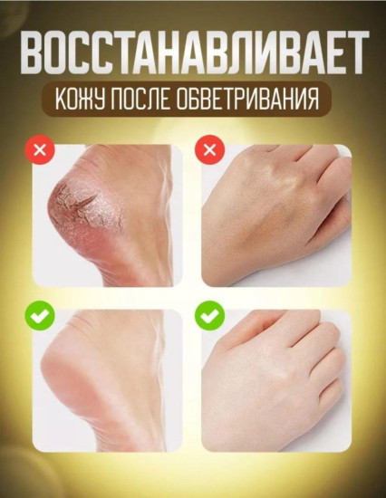 Крем-стик от трещин для кожи рук и ног, 7 гр