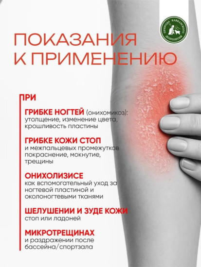 Мазь против грибка и зуда для тела, 100мл