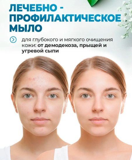 Мыло от демодекоза, прыщей, акне