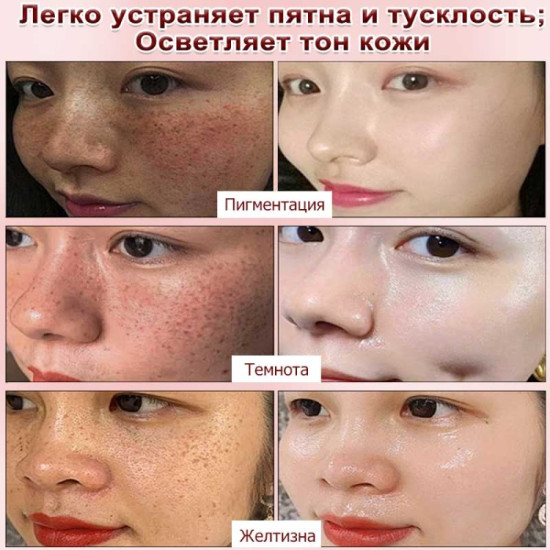 Крем Отбеливающий для лица, для области вокруг глаз 50 г