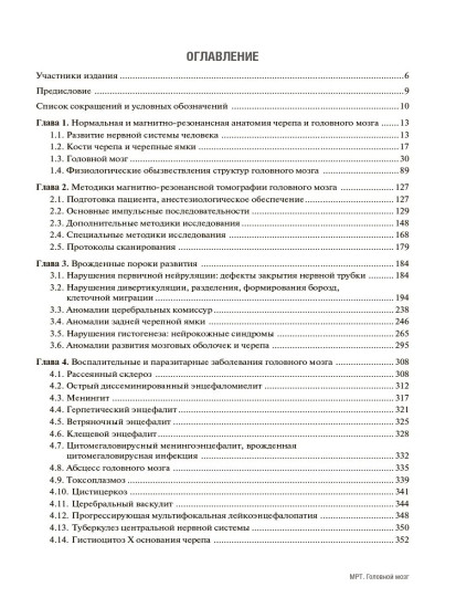 МРТ. Головной мозг