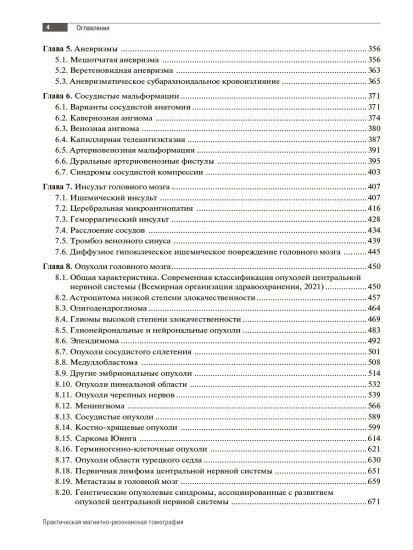 МРТ. Головной мозг