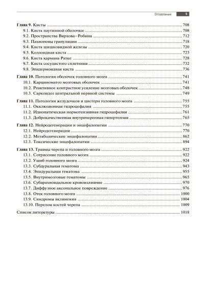 МРТ. Головной мозг