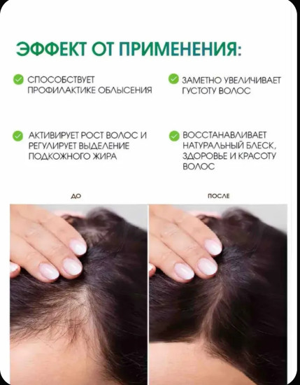 Шампунь от облысения с чесноком