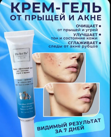Крем для лица от прыщей и угрей