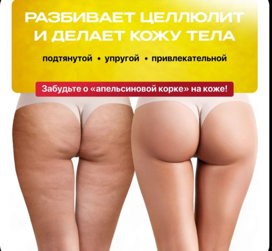 Крем антицеллюлитный
