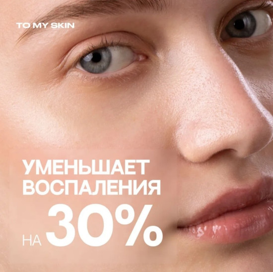 Сыворотка для лица от прыщей и для сужения пор «Niacinamide + Zinc»