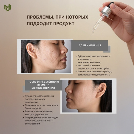 Сыворотка для удаления шрамов для лица 50 г