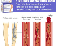 Крем от варикоза для ног облегчения усталости и отеков - Фото 2