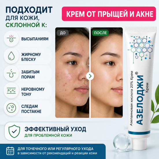 Крем от акне, прыщей и постакне с азелаиновой кислотой 20% Азелоджи, 30 г