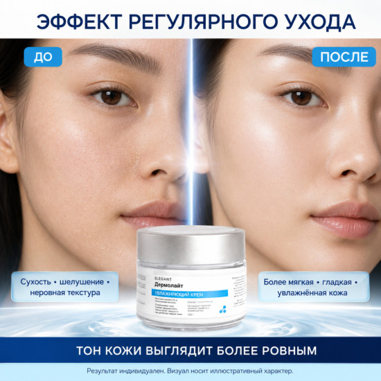 Увлажняющий крем от сухости и шелушения с молочной кислотой 5% и гиалуроновой кислотой Дермолайт, 100 г