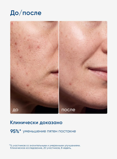 Сыворотка-протектор для кожи, склонной к акне «Clear Derm Protector Serum»