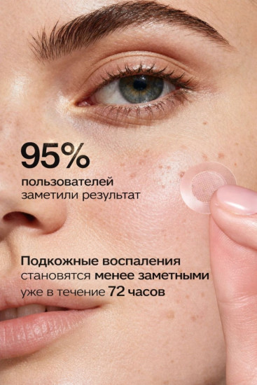 Патчи с микроиглами пост акне