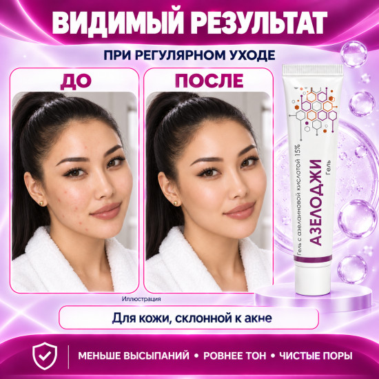 Гель от акне, комедонов и покраснений с азелаиновой кислотой 15% Азелоджи