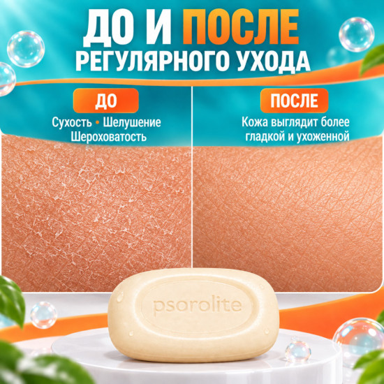 Мыло для ухода за кожей при псориазе с молочной и салициловой кислотами Псоролайт